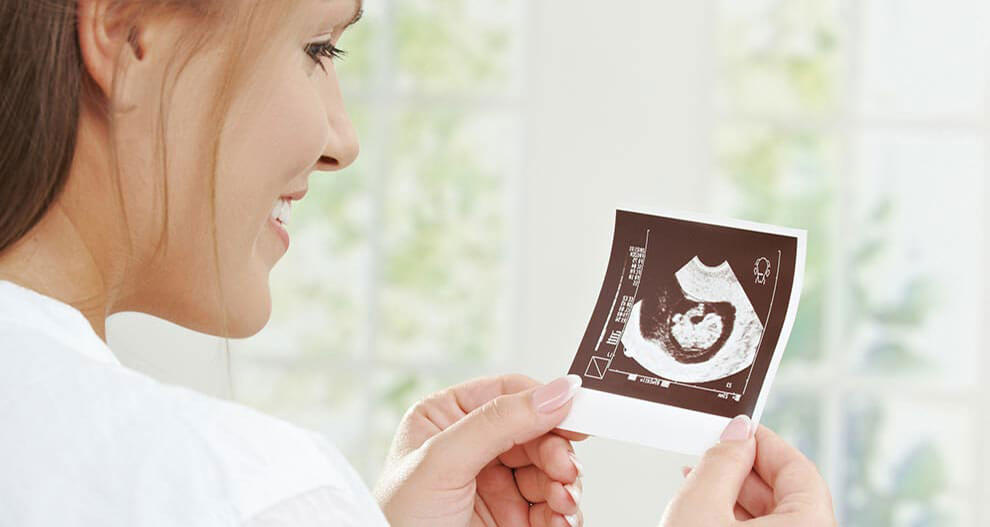 A woman in a white shirt is holding a black and white ultrasound image.